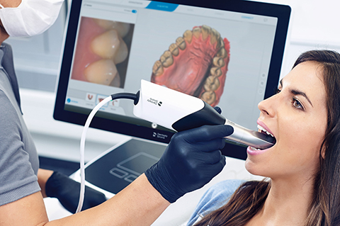 最短1日で白い歯!セレック治療を行っています